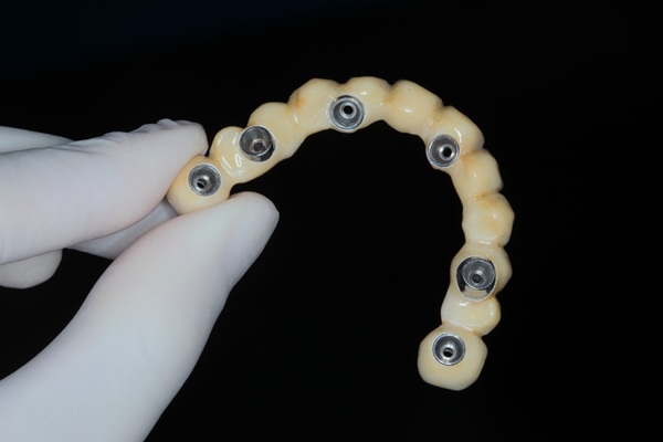 Oral Health Benefits Of Implant Supported Dentures