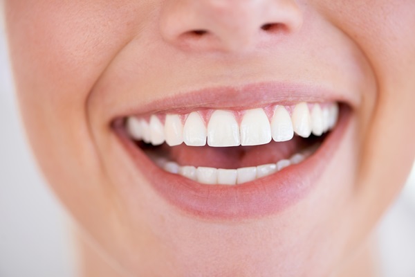 How Does In Office Professional Teeth Whitening Work?
