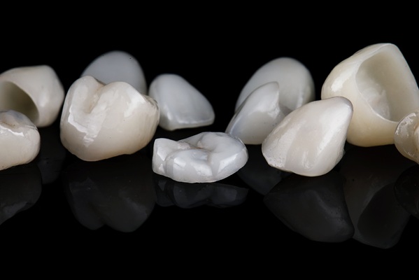 Same Day Crowns Vs  Traditional Crowns: Which Is Right For You?